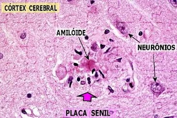 Histo jigsaw puzzle